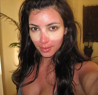 Kim Kardashian Gets Burned.  Photo: Kim Kardashian Via Twitter.com