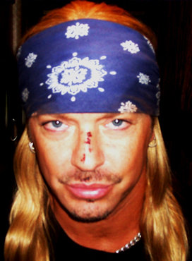 Bret Michaels & A Busted Nose.  Photo: Bret Michaels Via Facebook